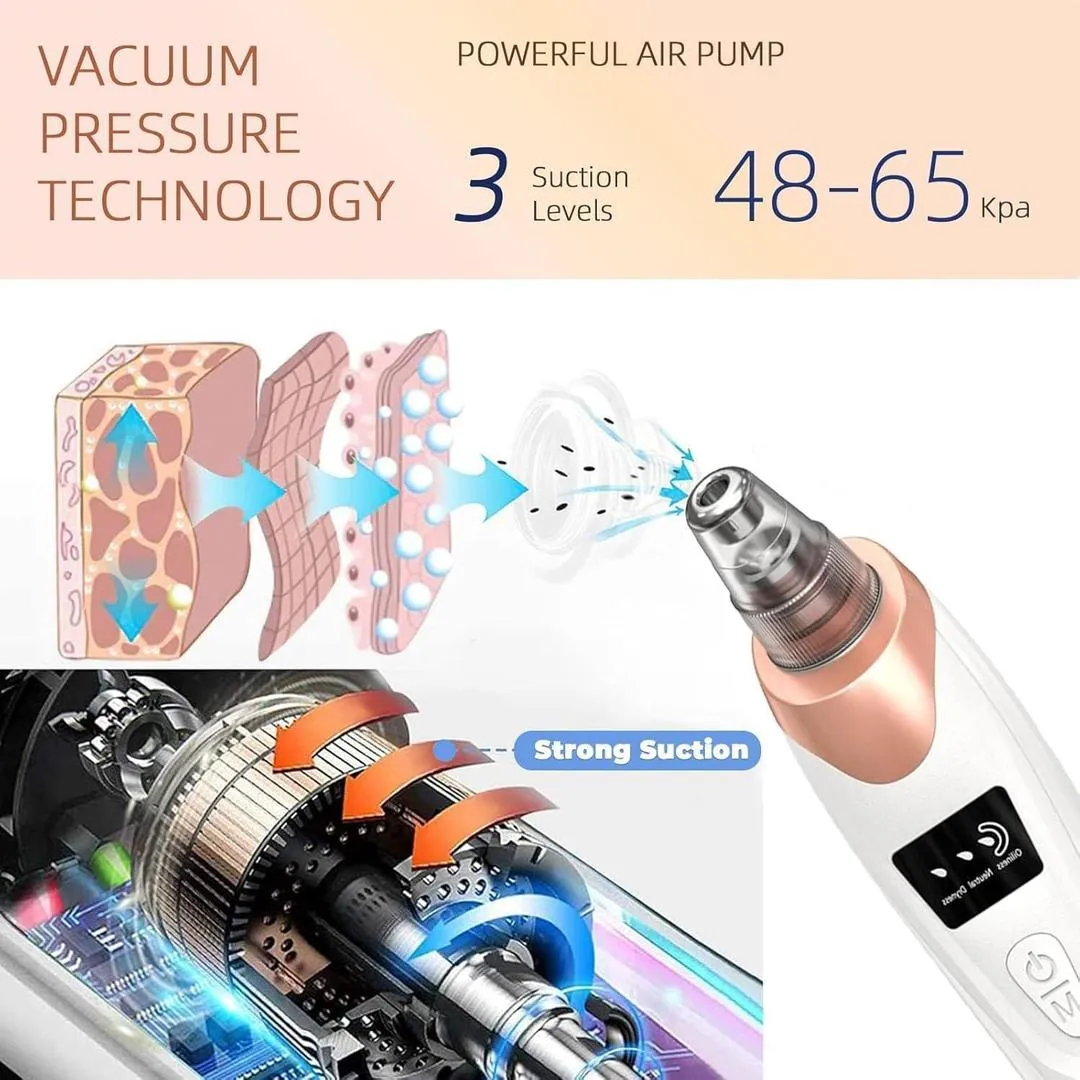 5-in-1 Electric Blackhead Remover USB Rechargeable - Image 4