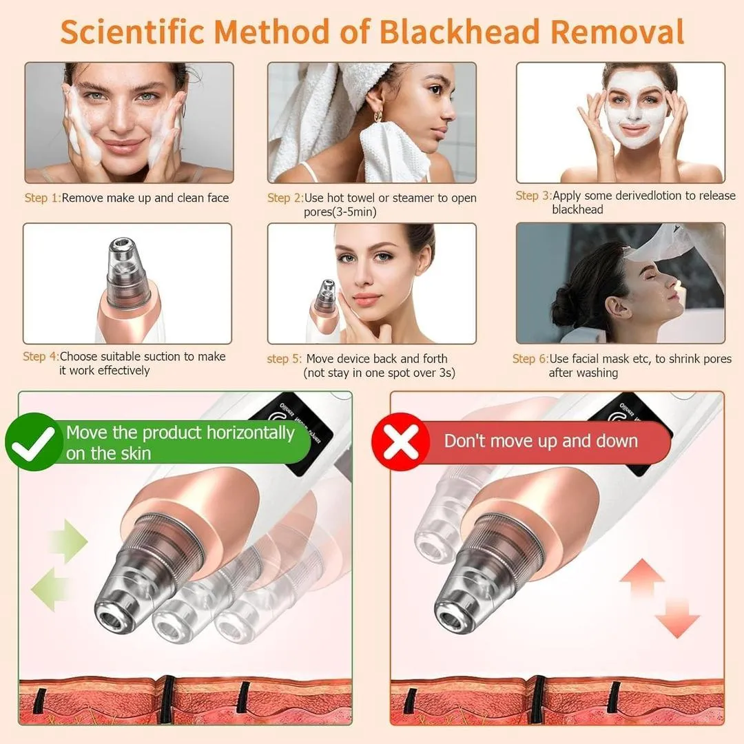 5-in-1 Electric Blackhead Remover USB Rechargeable - Image 5